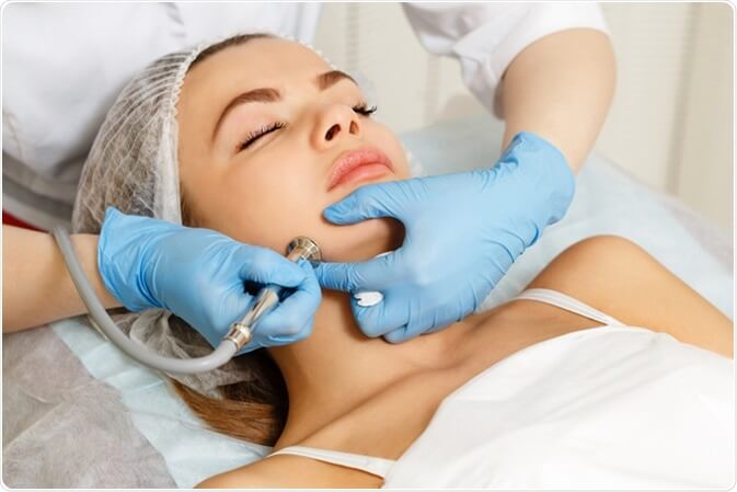 dermabrasion